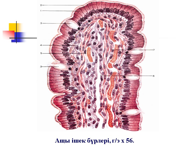 Ащы ішек бүрлері, г/э х 56.